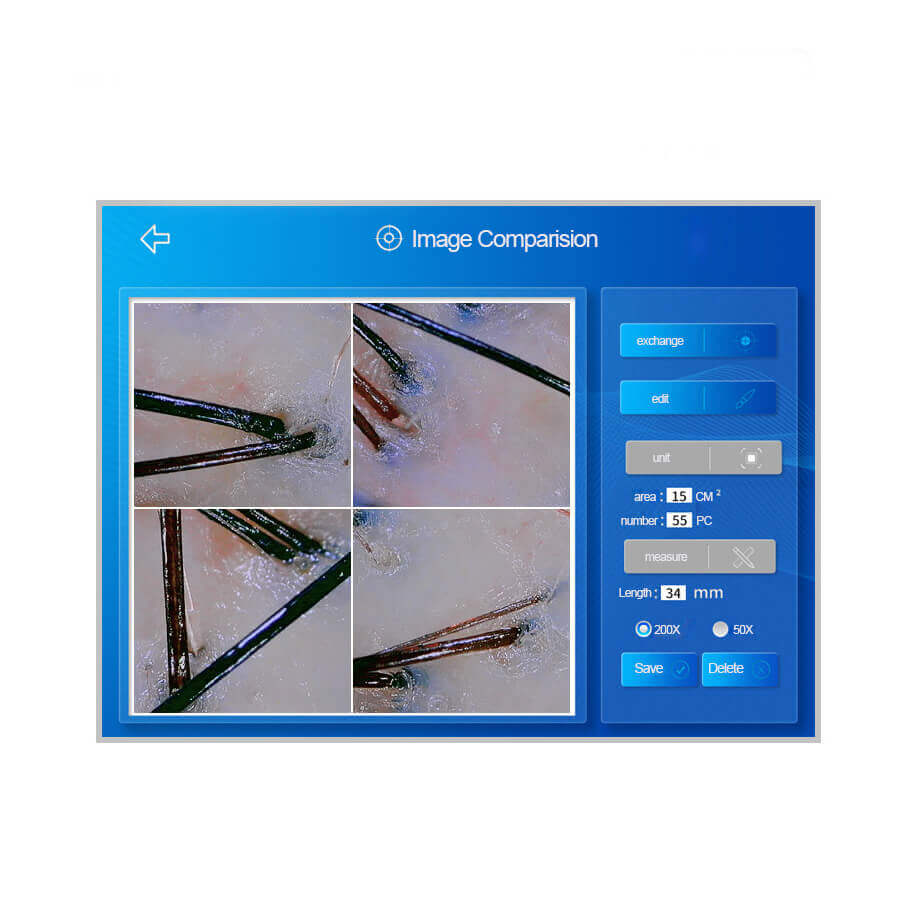 hair scalp analysis machine