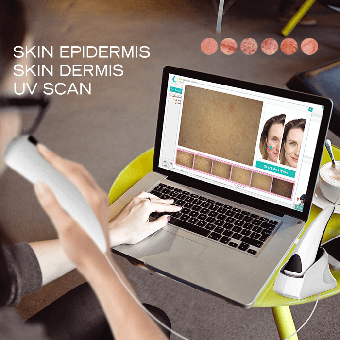 USB skin analysis
