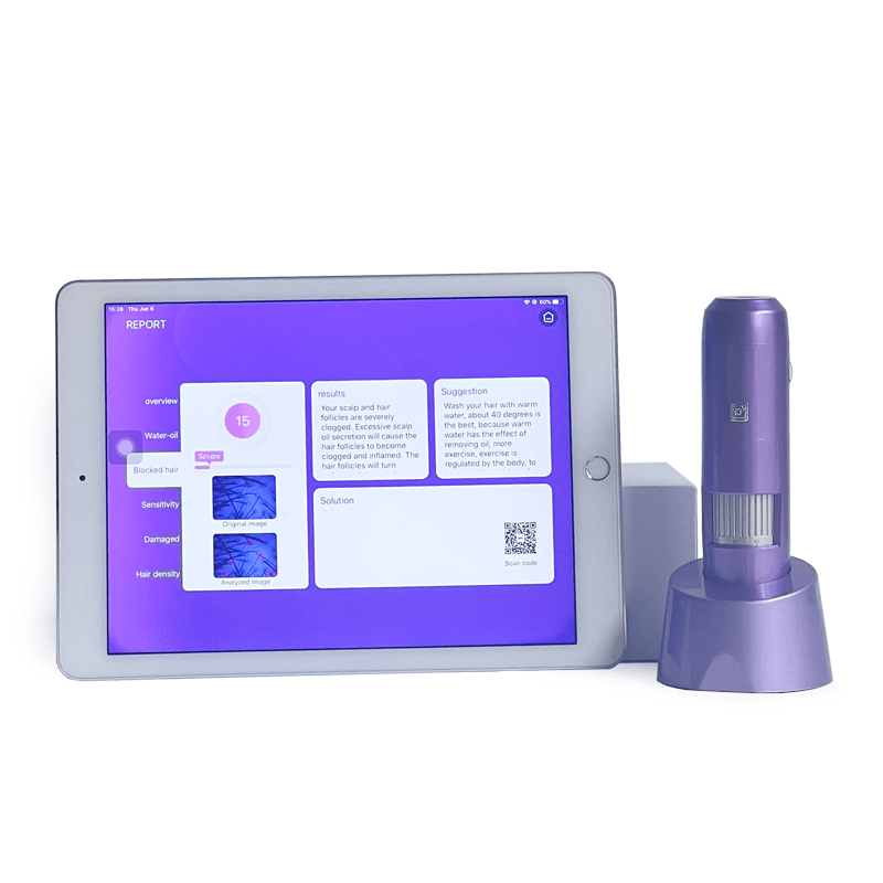 wireless scalp analysis