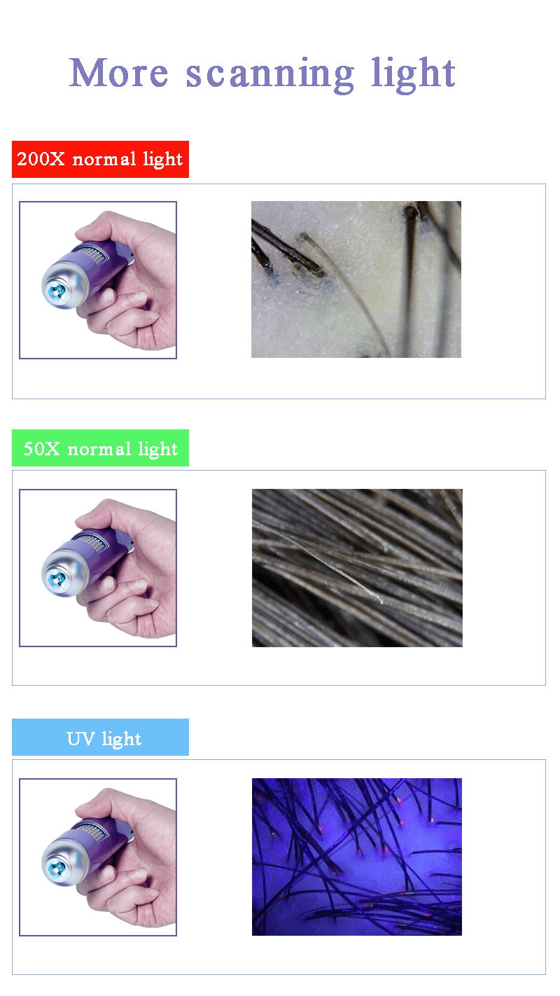 WIFI hair scalp analysis