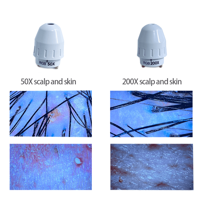 hair scalp analyzer