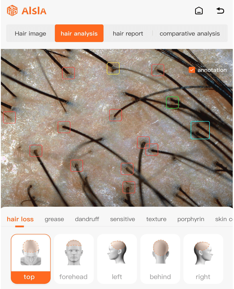 hair analyzer